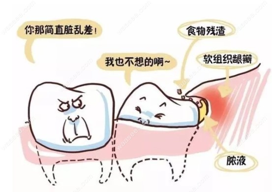 河南拔智齿什么梗的简单介绍